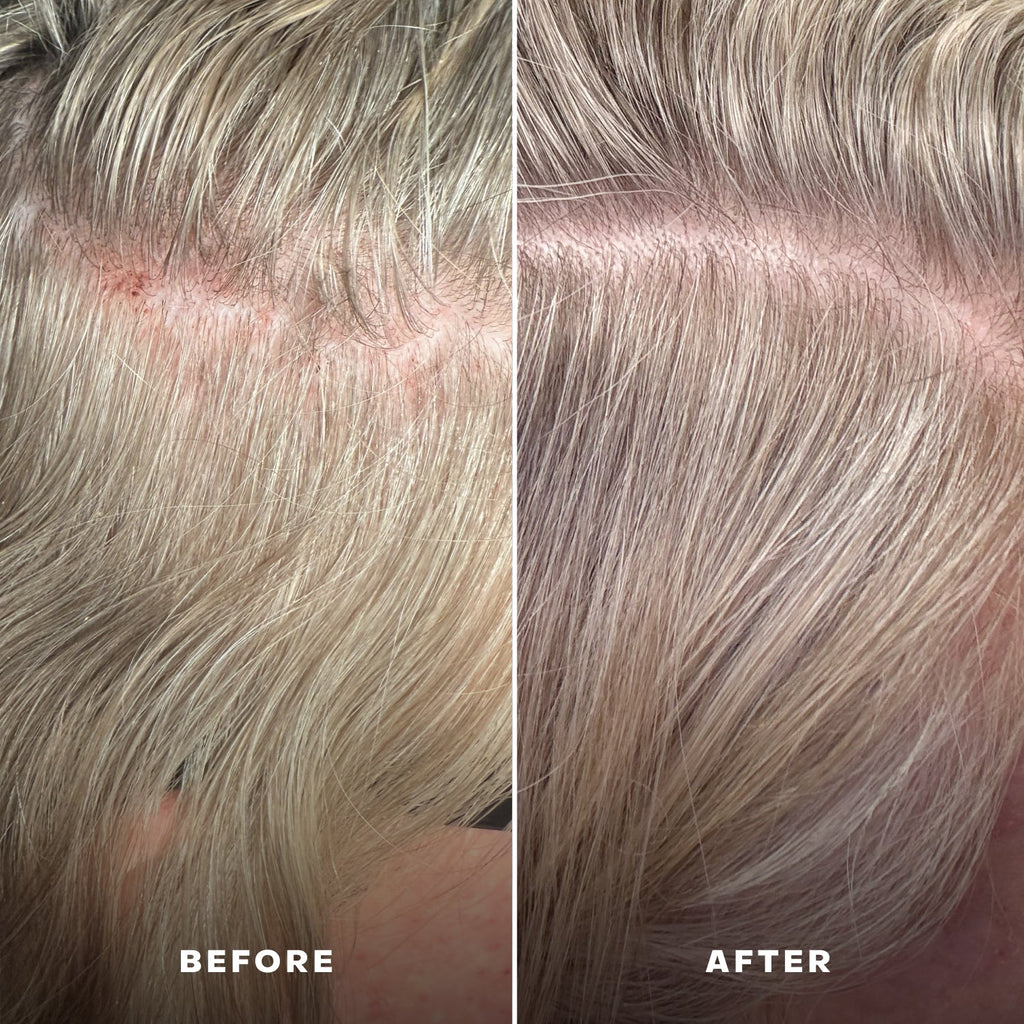 Routine Ready EverBoost Multi-Peptide Scalp Serum for daily home and personal routines with hair care