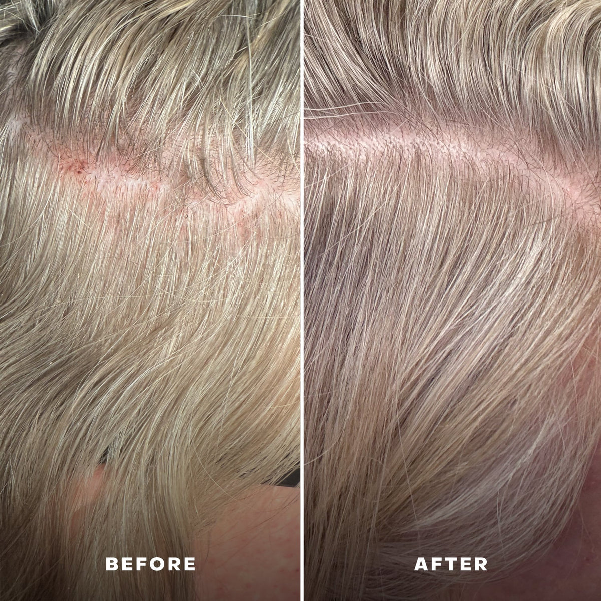 Routine Ready EverBoost Multi-Peptide Scalp Serum for daily home and personal routines with hair care