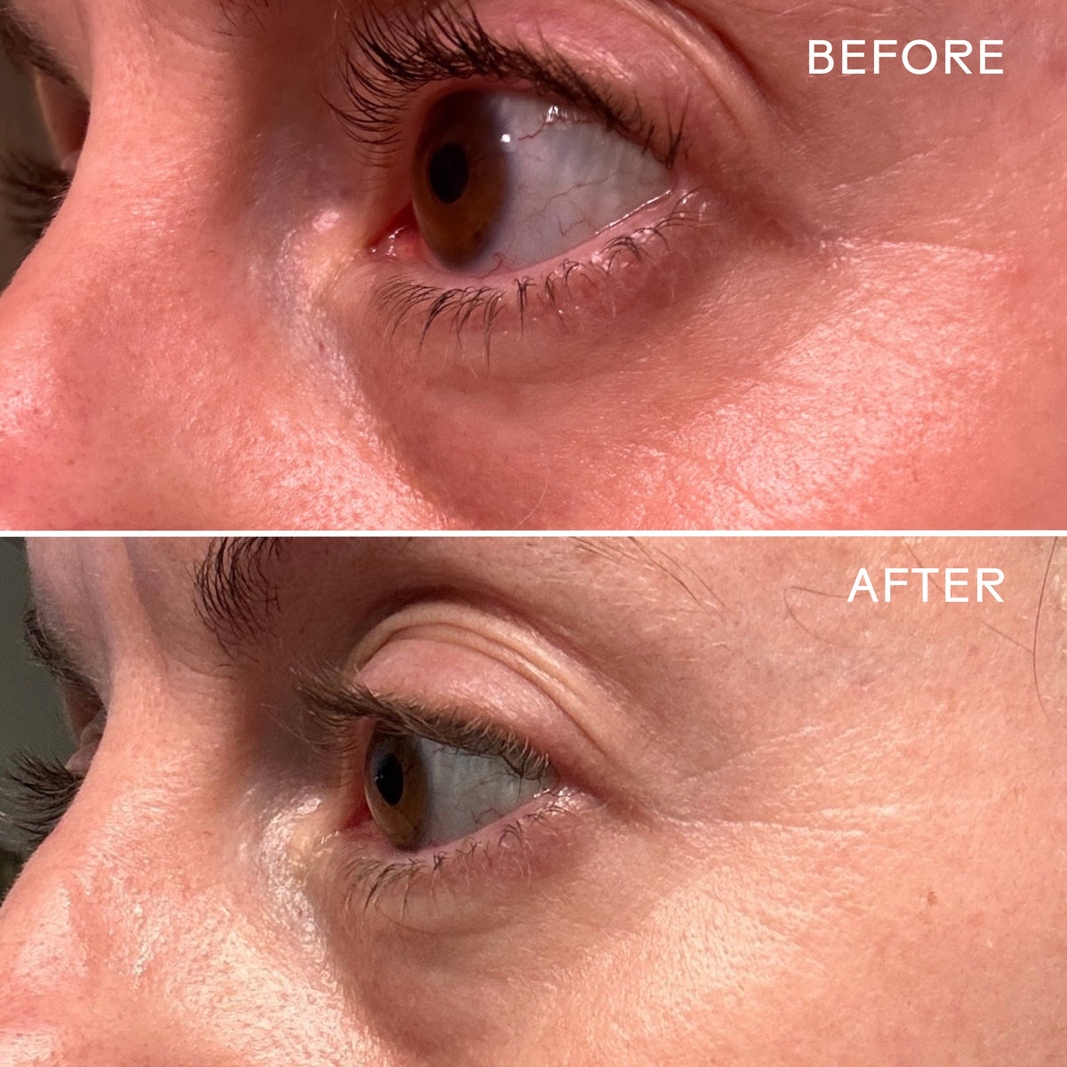 Daily Care EyeHero Bio-Retinol Smoothing Eye Cream for daily home and personal routines with facial skin and sun care