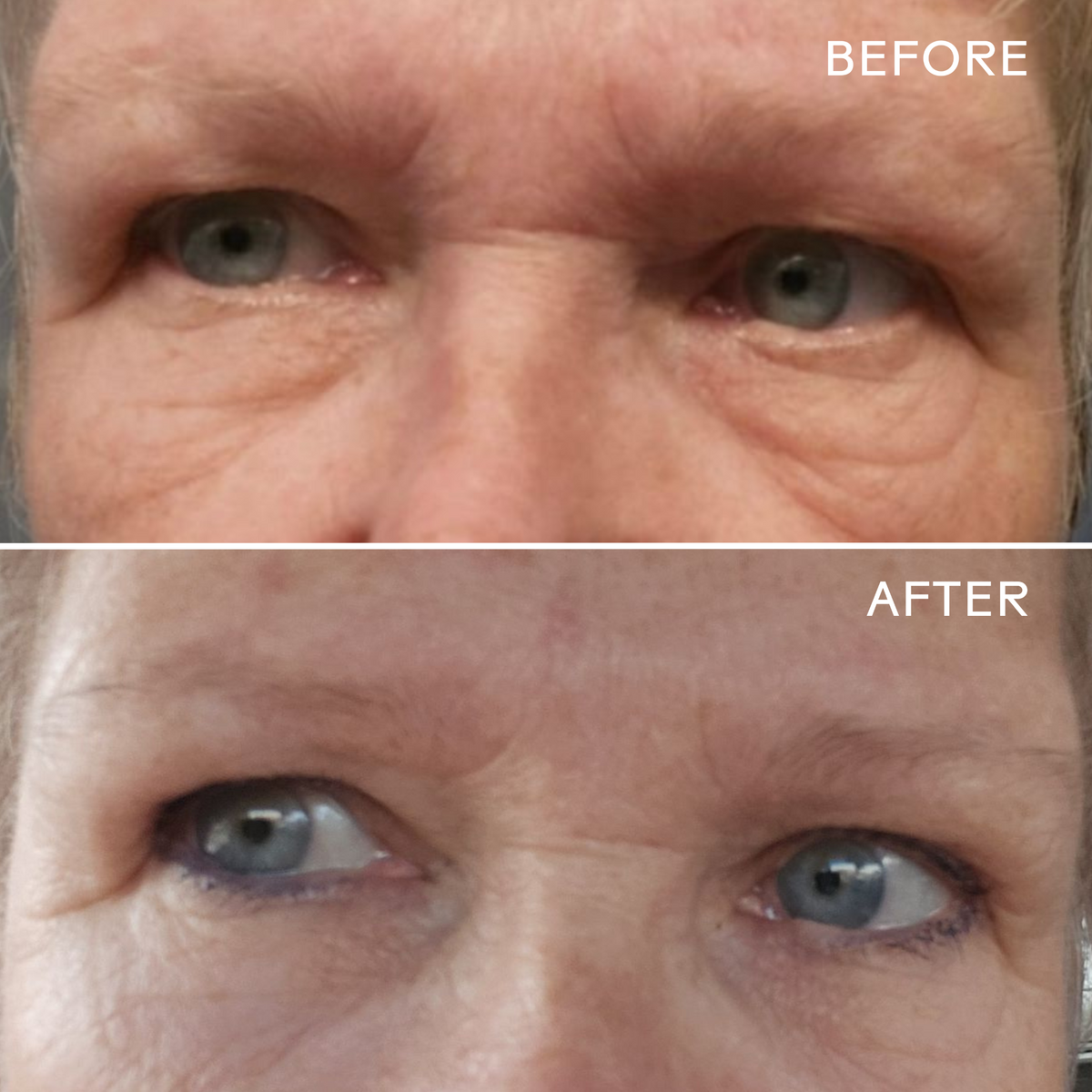 Daily Care EyeHero Bio-Retinol Smoothing Eye Cream for daily home and personal routines with facial skin and sun care