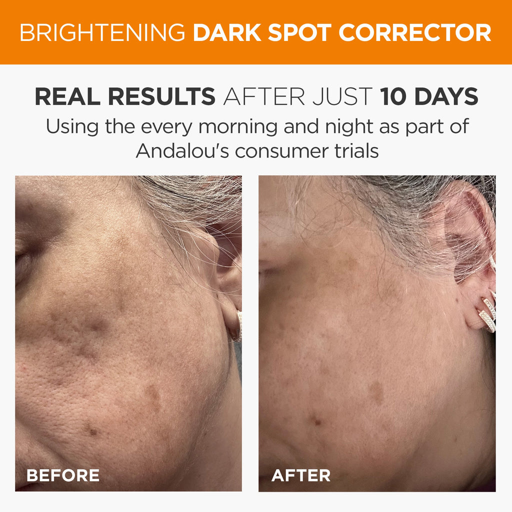 Everyday Home Brightening Dark Spot Corrector for daily home and personal routines with cookware food storage and kitchen tools
